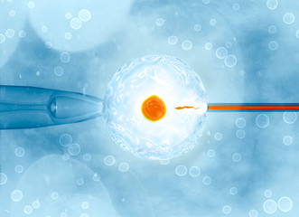 Artificial or assisted fertilization is the process by which the union of gametes is artificially carried out, by observation under a microscope, 3d rendering