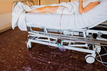 Intravenous cannula placed in the hand of an elderly patient for palliative care of a terminal patient.