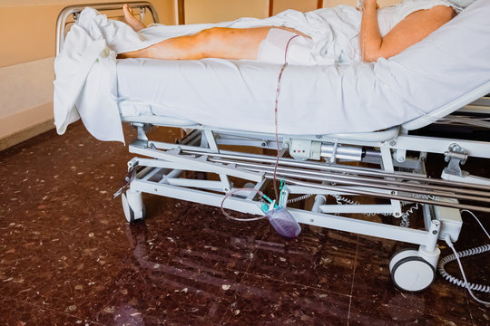 Intravenous cannula placed in the hand of an elderly patient for palliative care of a terminal patient.