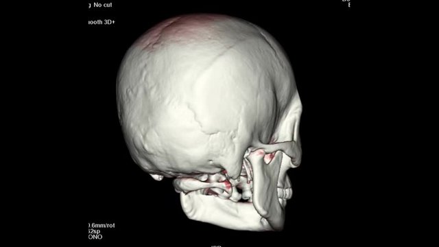 3D Skull in black background colour. 3D Illustration. 3D Rendering.
