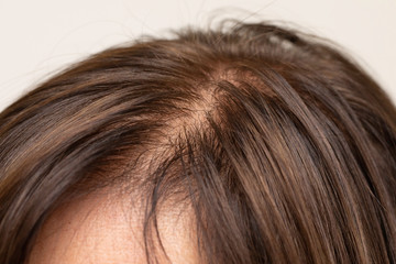 Female hair parting close up