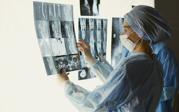 Two female women medical doctors looking at x-rays in a hospita