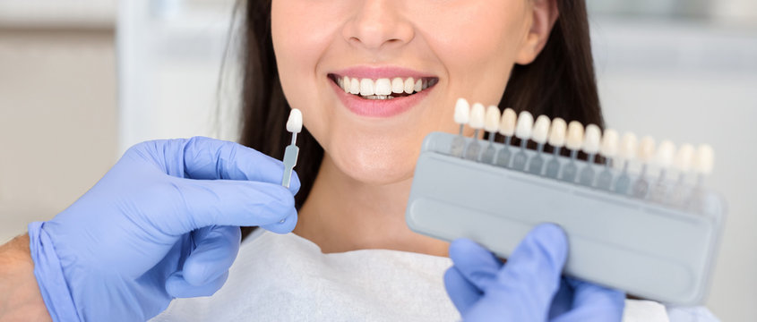 Dentist applying sample from tooth scale to happy patient teeth