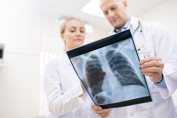 X-ray of lungs or spinal cors held by one of doctors during consultation