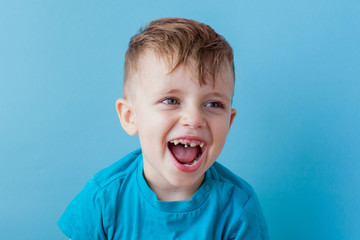 Extensive early dental caries and misaligned and spare incisor teeth in upper jaw © volody10