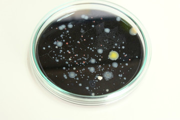 microorganism in petridish