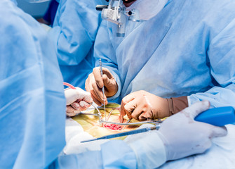 Obraz na płótnie Canvas Spinal surgery. Group of surgeons in operating room with surgery equipment. Laminectomy