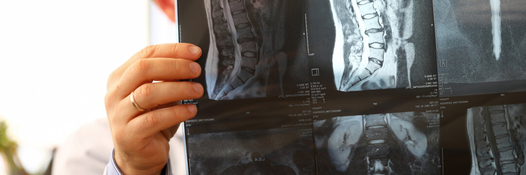 GP holding in arms vertebral CT scan detecting problem