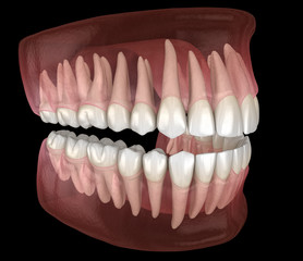 Morphology of mandibular and maxillary human gum and teeth. Medically accurate tooth 3D illustration