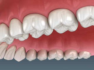 Maxillary human gum and teeth. Medically accurate tooth 3D illustration