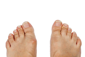 Long toenails. Isolate on a white background.