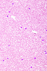 Picture of white blood cell, red blood cell and platelet in blood film, analyze by microscope, 400x 