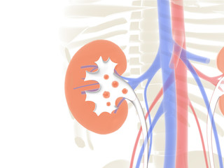 3D anatomical and line illustration of the inside of the kidney, with kidney stones, on a graphic background of the human body.