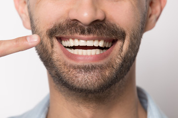 Close up of smiling man showing white healthy teeth