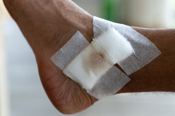 Closeup injured at leg, Fresh wounds from accident. 