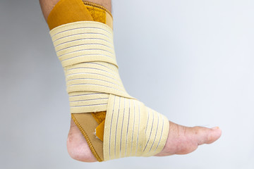 Closeup injured at leg, Fresh wounds from accident. 