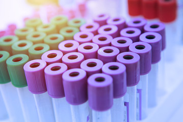 Blood sample for testing.Medical equipment