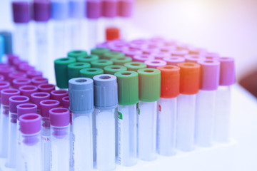 Blood sample for testing.Medical equipment