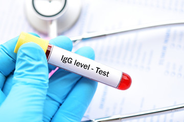 Blood sample tube for Immunoglobulin G or IgG level test, diagnosis for immunodeficiency disease