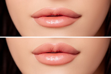 Sexy Sensual Lip. Female lips before and after augmentation procedure lips. Peach Lip Gloss....