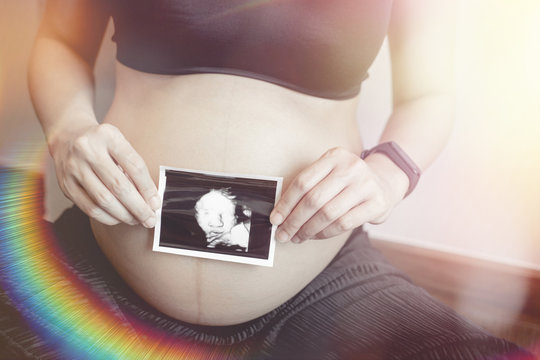 pregnant woman holding her ultrasoud photo.