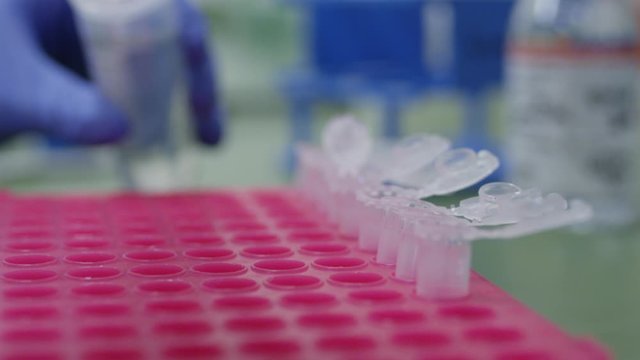 Clinical laboratorist putting  putting liquid with pipette in beakers.