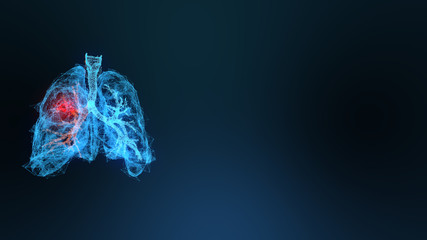 3d rendered illustration of lung cancer 3D illustration - obrazy, fototapety, plakaty