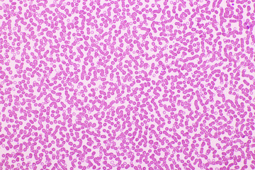 Red blood cells in blood smear, Wright-Giemsa stain, analyze by microscope, 400x