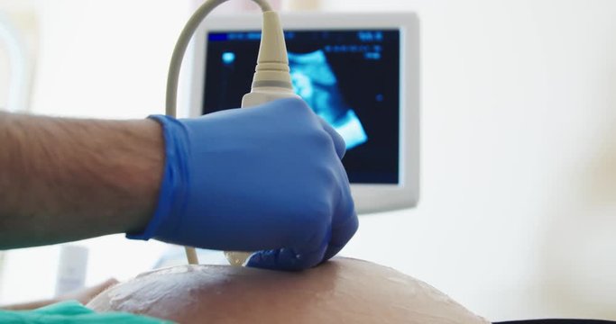 A doctor doing a USG scan on a pregnant woman's belly