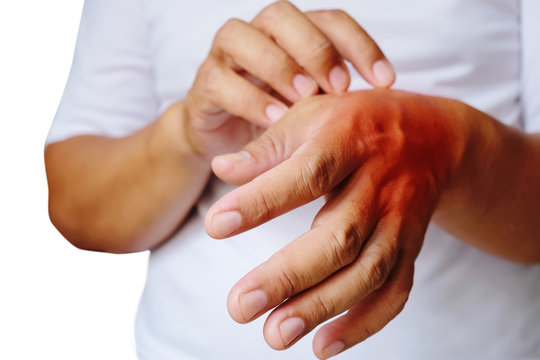 Itching of skin diseases in men using the hand-scratching. Red around the Itching area.