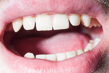 Man's open mouth close-up teeth. Clean natural teeth.