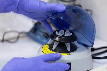 Polymerase Chain Reaction (PCR) and Agarose gel electrophoresis is a method of gel electrophoresis used in biochemistry, molecular biology, genetics, and clinical chemistry in lab.