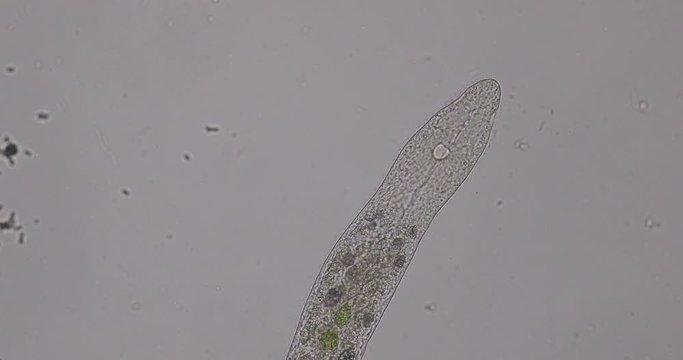 Protozoa parasite,Bacterium and Algae in waste water under the microscope.