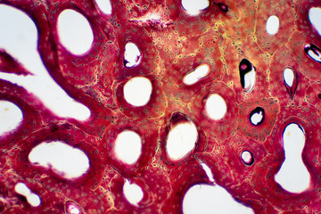 Histology of human compact bone tissue under microscope view for education.