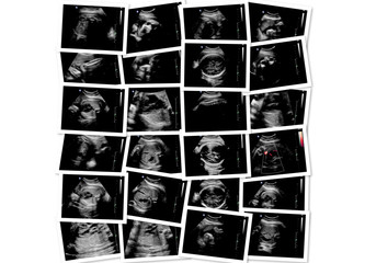 Collection of images from ultrasound scan examination