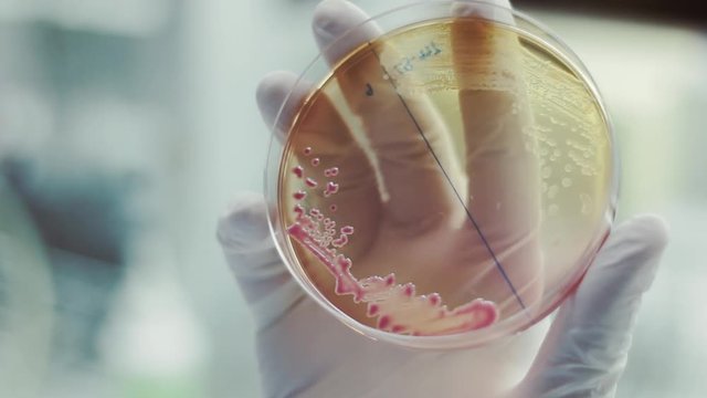 a single visible colony of bacteria growing on an agar plate represents