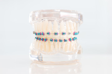 Dental model with toothbrush
