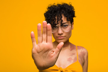 Young african american woman with skin birth mark standing with outstretched hand showing stop...