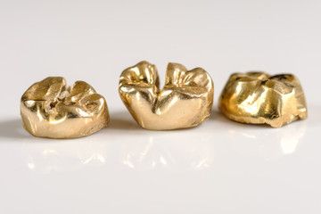 Drei goldene Zähne - entnommenes Zahngold