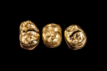 Drei Goldzähne / Zahngold