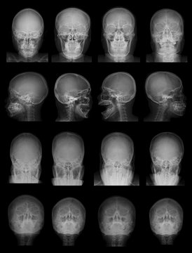 Collection X-ray image of skulls