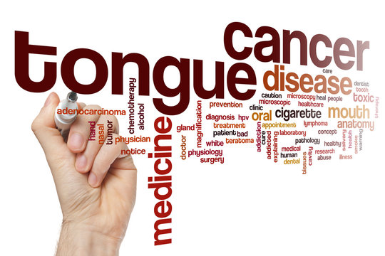 Tongue cancer word cloud