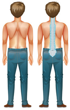 recommend clip art: Man showing spinal cord injury