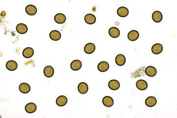 Eggs of Taenia or tapeworm in stool, analyze by microscope, original magnification 400x
