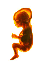 human fetus cross section