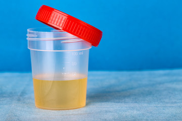 New Plastic container with urine analysis