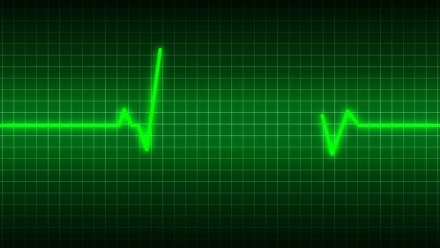 Heart beat cardiogram animation. Heart monitor EKG electrocardiogram pulse seamless loop background.