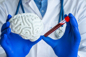 Laboratory medical diagnostics, tests for brain and neurological system concept photo. Doctor or laboratory technician holds in one hand laboratory test tube with blood, in other - figure of brain