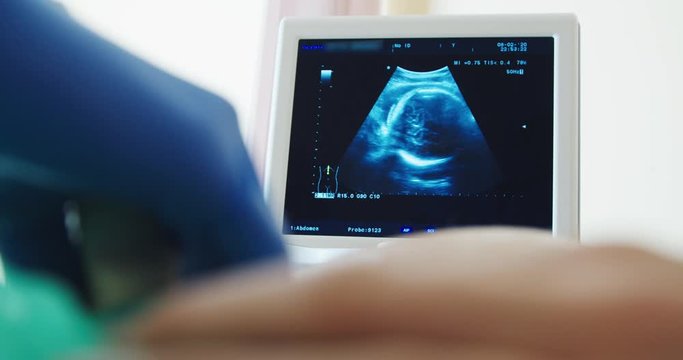 The camera pans left to the screen of the ultrasound scan