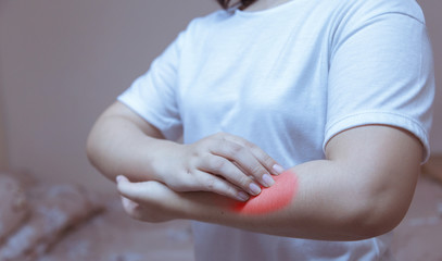 woman scratching arm from having itching allergic reaction to insect bites, dermatitis, food, drugs. Health care concept.